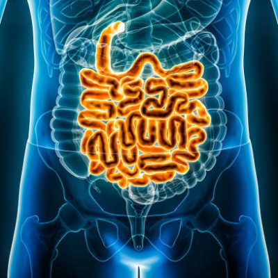 شناخت بهتر از انسداد، چسبندگی و پیچ خوردگی روده شناخت بهتر از انسداد، چسبندگی و پیچ خوردگی روده