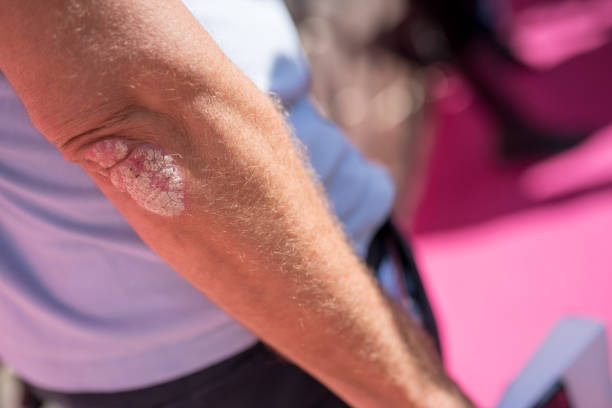 Skin diseases from the club