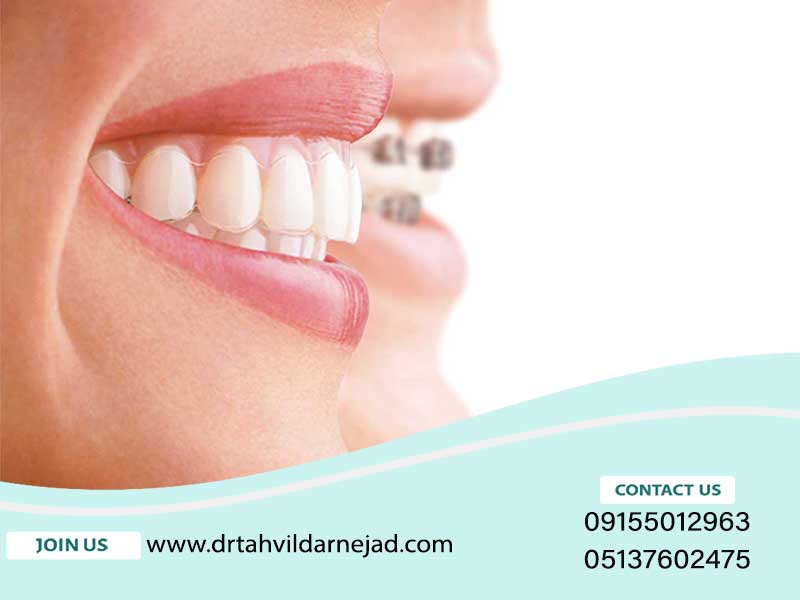 ارتودنسی لیزری چیست؟ ارتودنسی لیزری چیست؟