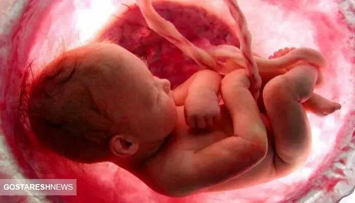 رحم اجاره‌ای ۹۰۰ میلیونی ! | دلالی غیر قانونی در کشور