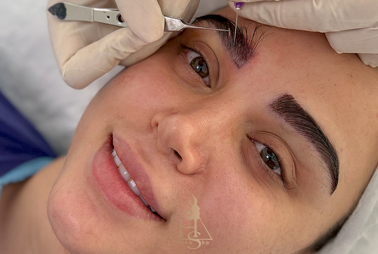 کاشت ابرو طبیعی؛ تفاوت روشهای جراحی و غیرجراحی کاشت ابرو طبیعی؛ تفاوت روشهای جراحی و غیرجراحی