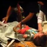 چرخ‌گوشت مچ دست کودک اصفهانی را قطع کرد